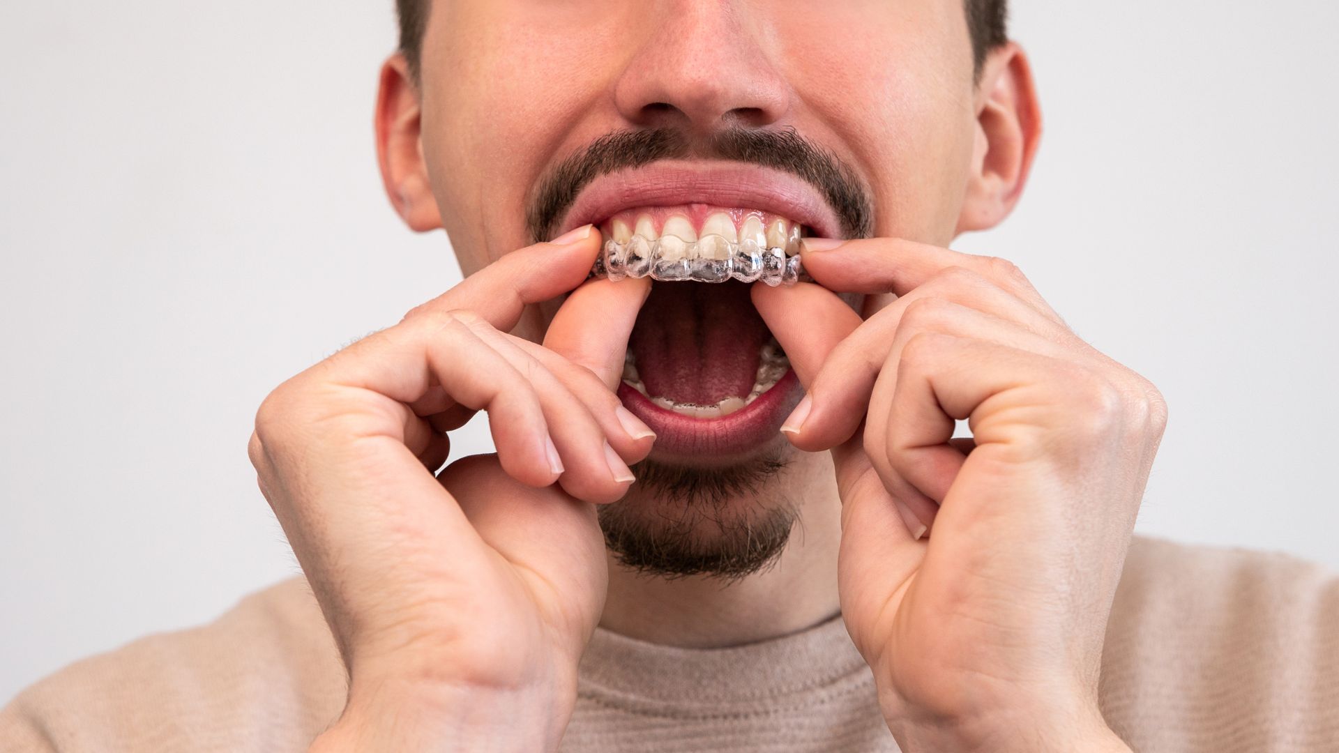 How to use Invisalign Cleaning Crystals Step by Step Guide Smile