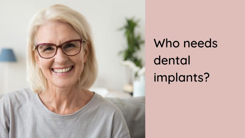 do you need dental implants