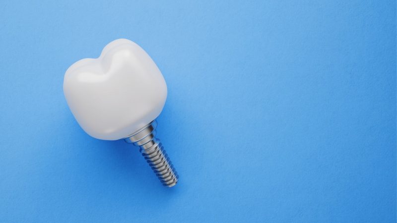who may not be suitable for dental implants
